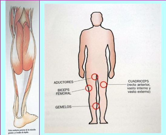 ciervo Deshabilitar A pie Lesiones Musculares. Generalidades. Dra. Yolanda Puentes - Championchip